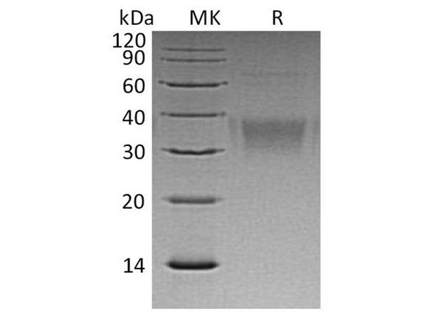 Recombinant Human Ephrin-B2/EFNB2 Protein (His Tag) – Figure 1 of 2