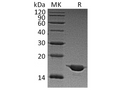 Recombinant Human Alpha-Synuclein/SNCA Protein – Figure 1 of 3