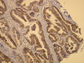 Anti-C-erb-2 (Her-2/neu) – Figure 1 of 2