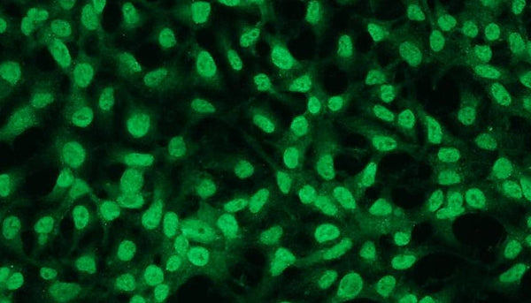 Anti-Bcl-2 – Figure 2 of 3