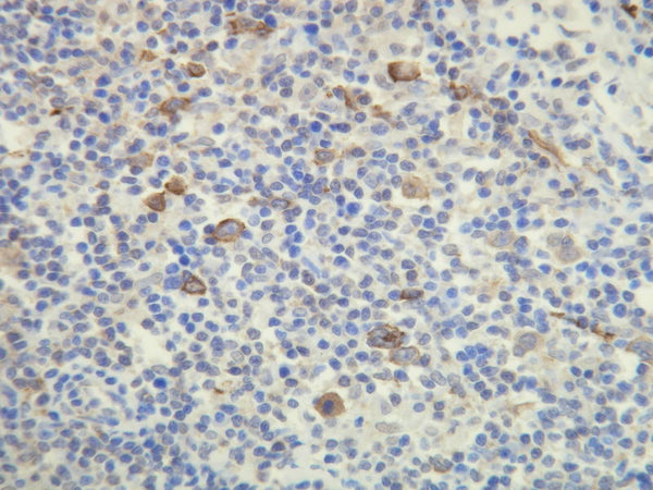 Anti-CD15 – Figure 1 of 1