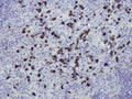 Anti-Human IgG – Figure 1 of 1