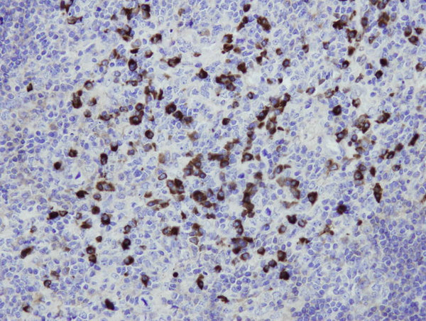 Anti-Human IgG – Figure 1 of 1