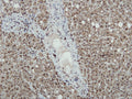 Liver tissue stained with anti-iNOS (DB 003-IHC) showing strong positive immunostaining of hepatocytes, IHC.