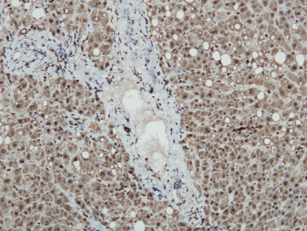 Liver tissue stained with anti-iNOS (DB 003-IHC) showing strong positive immunostaining of hepatocytes, IHC.