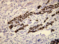 Anti-p53 – Figure 1 of 1