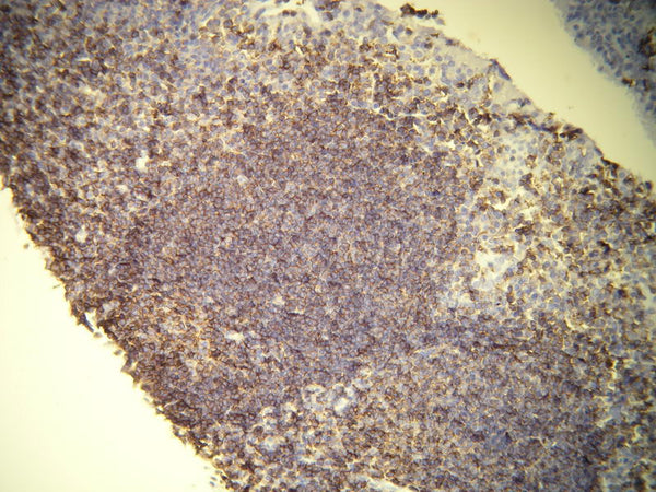 Anti-CD45 – Figure 1 of 2