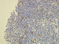Anti-CD163 – Figure 1 of 3