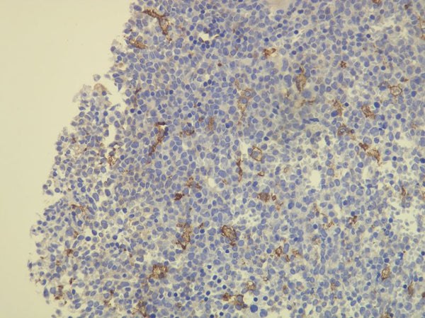 Anti-CD163 – Figure 1 of 3