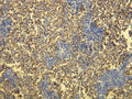 Anti-PLAP (Placental Alkaline Phosphatase) – Figure 1 of 1