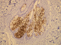 Anti-EMA (CD227, Mucin-1) – Figure 1 of 2