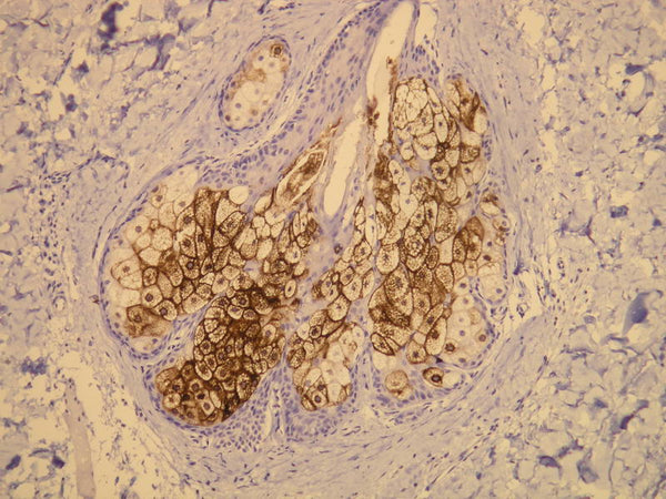 Anti-EMA (CD227, Mucin-1) – Figure 1 of 2