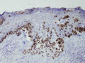 Anti-Melanosome – Figure 1 of 1