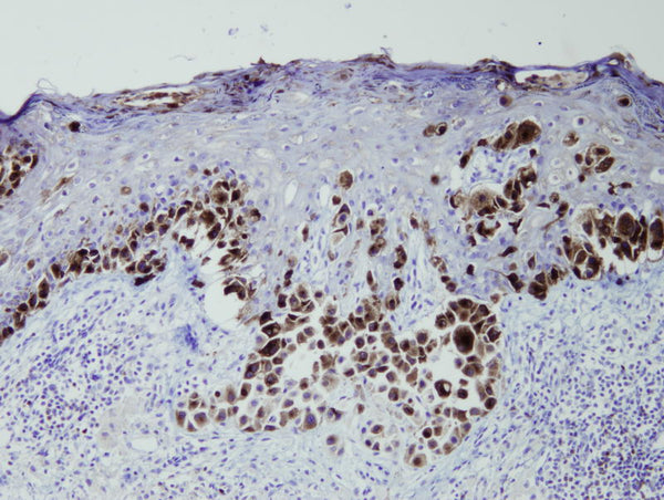 Anti-Melanosome – Figure 1 of 1