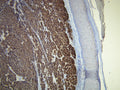 Anti-Melan A – Figure 1 of 1