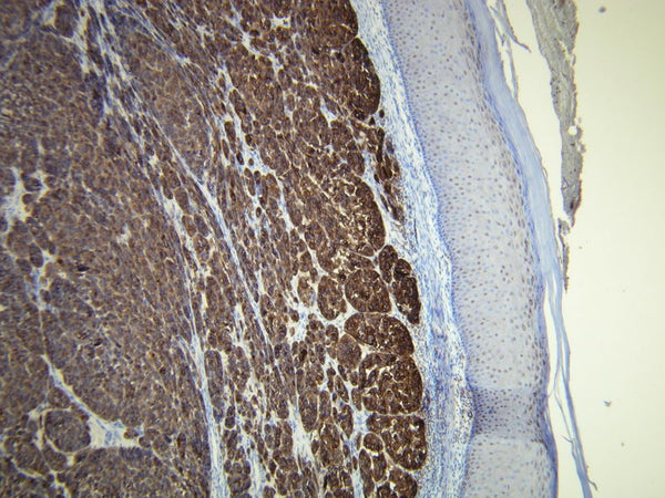 Anti-Melan A – Figure 1 of 1