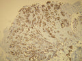 Anti-Cytokeratin 7 – Figure 1 of 3