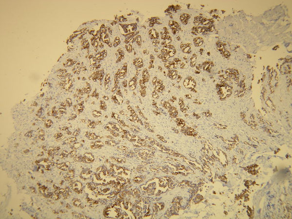 Anti-Cytokeratin 7 – Figure 1 of 3