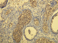 Anti-CD117 – Figure 1 of 3