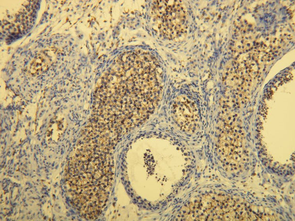 Anti-CD117 – Figure 1 of 3