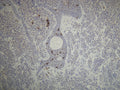Anti-CD1a – Figure 1 of 2