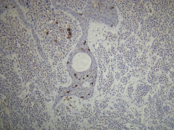 Anti-CD1a – Figure 1 of 2