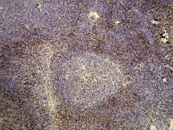 Anti-CD3 – Figure 1 of 1