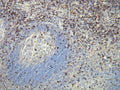 Anti-CD8 – Figure 1 of 1