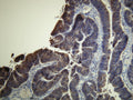 Anti-EGFR – Figure 1 of 1