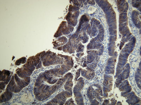 Anti-EGFR – Figure 1 of 1