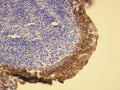 Anti-Cytokeratin 5/6 – Figure 1 of 2