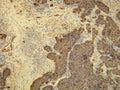 Anti-Cytokeratin 8 – Figure 1 of 1