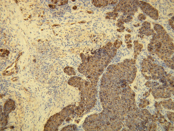 Anti-Cytokeratin 8 – Figure 1 of 1