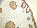 Anti-Cytokeratin 14 – Figure 1 of 3