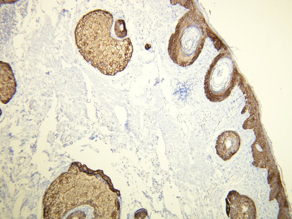 Anti-Cytokeratin 14 – Figure 1 of 3