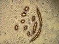 Anti-Cytokeratin 16 – Figure 1 of 1