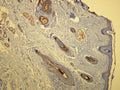 Anti-Cytokeratin 17 – Figure 1 of 1