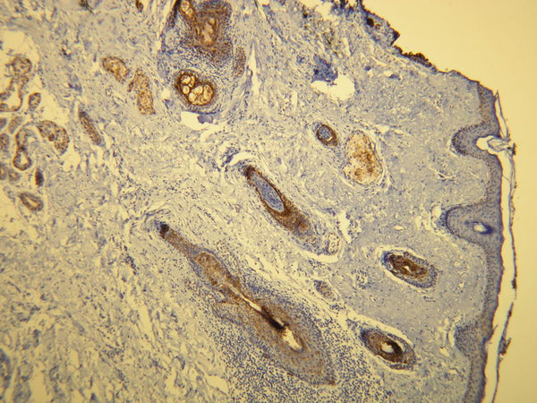 Anti-Cytokeratin 17 – Figure 1 of 1