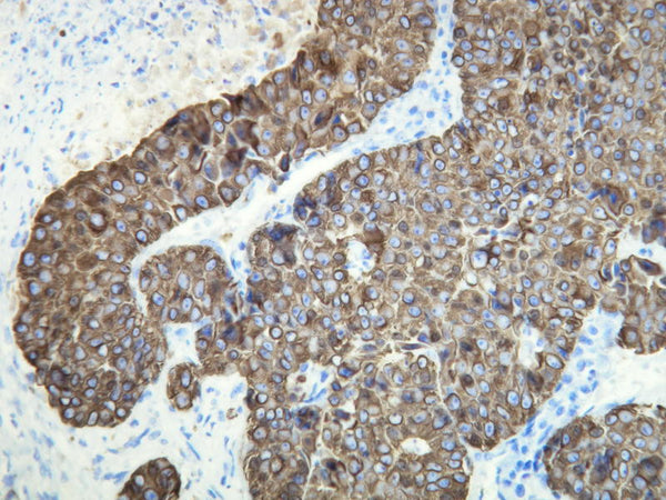Anti-Cytokeratin 18 – Figure 1 of 1