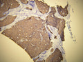 Anti-Cytokeratin 19 – Figure 1 of 2