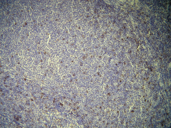 Anti-CD7 – Figure 1 of 2
