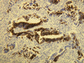 Anti-Cytokeratin 20 – Figure 1 of 4