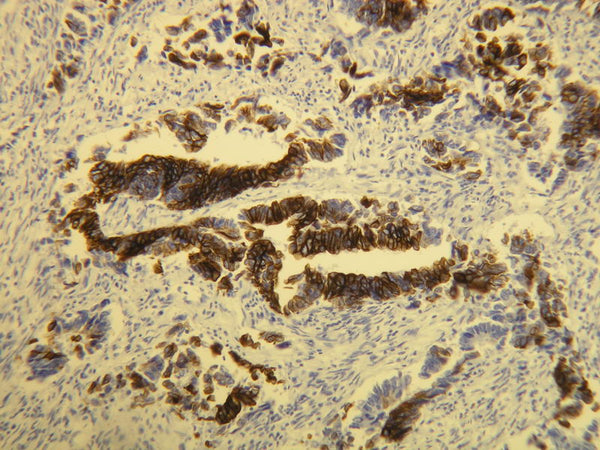 Anti-Cytokeratin 20 – Figure 1 of 4