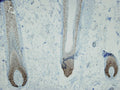 Nuclear p63 expression in normal hair follicles, anti-p63 (DB 134, clone I27-I), IHC.