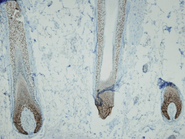 Nuclear p63 expression in normal hair follicles, anti-p63 (DB 134, clone I27-I), IHC.