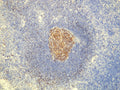 Anti-CD23 – Figure 1 of 1
