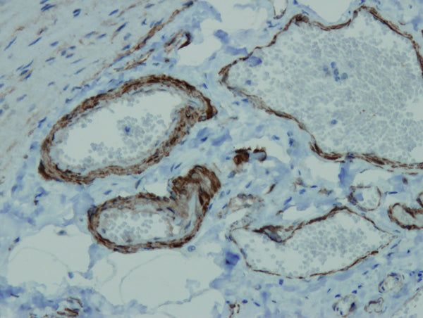 Anti-Alpha Smooth Muscle Actin – Figure 1 of 1