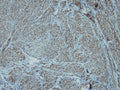 Anti-Desmin – Figure 1 of 1