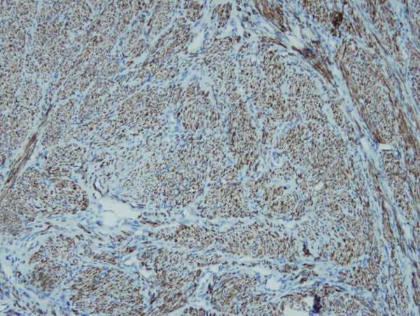 Anti-Desmin – Figure 1 of 1