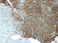 Anti-CD34 – Figure 1 of 2
